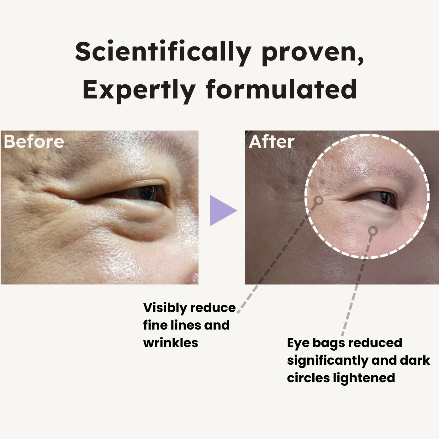 LED+EMS Anti Dark Circles Eye Cream