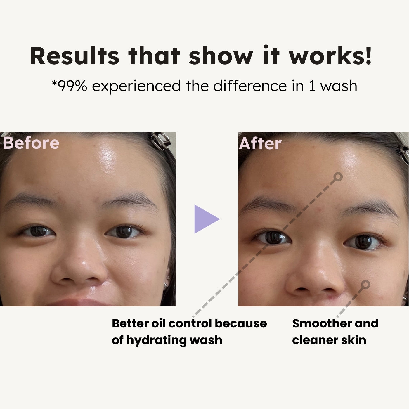 Vitamin C Refreshing Cleansing Mousse with Anti-bacterial Brush