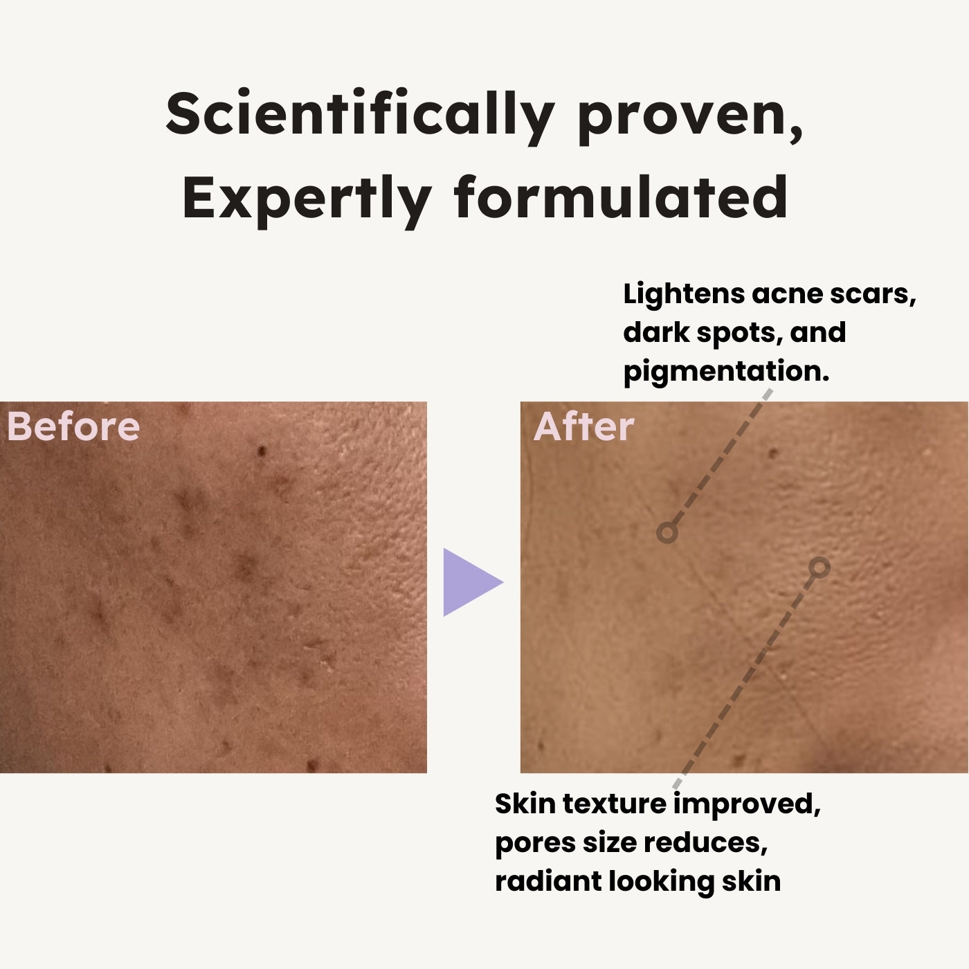 Vitamin C + Niacinamide Dual Serum