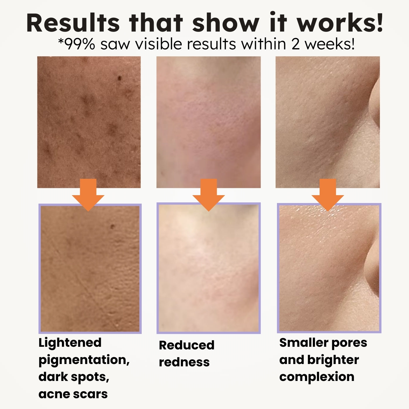 Vitamin C + Niacinamide Dual Serum