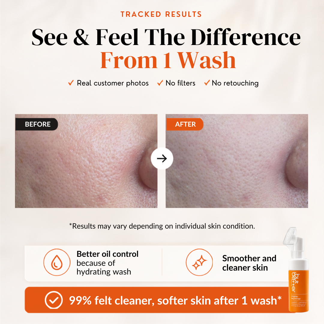 [35% OFF] Bundle Deals - Serum + Cleanser