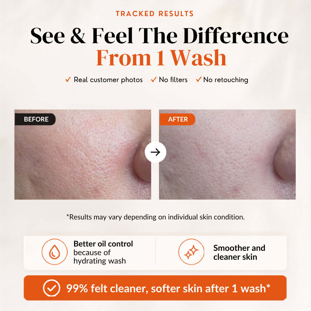 Vitamin C Refreshing Cleansing Mousse with Anti-bacterial Brush