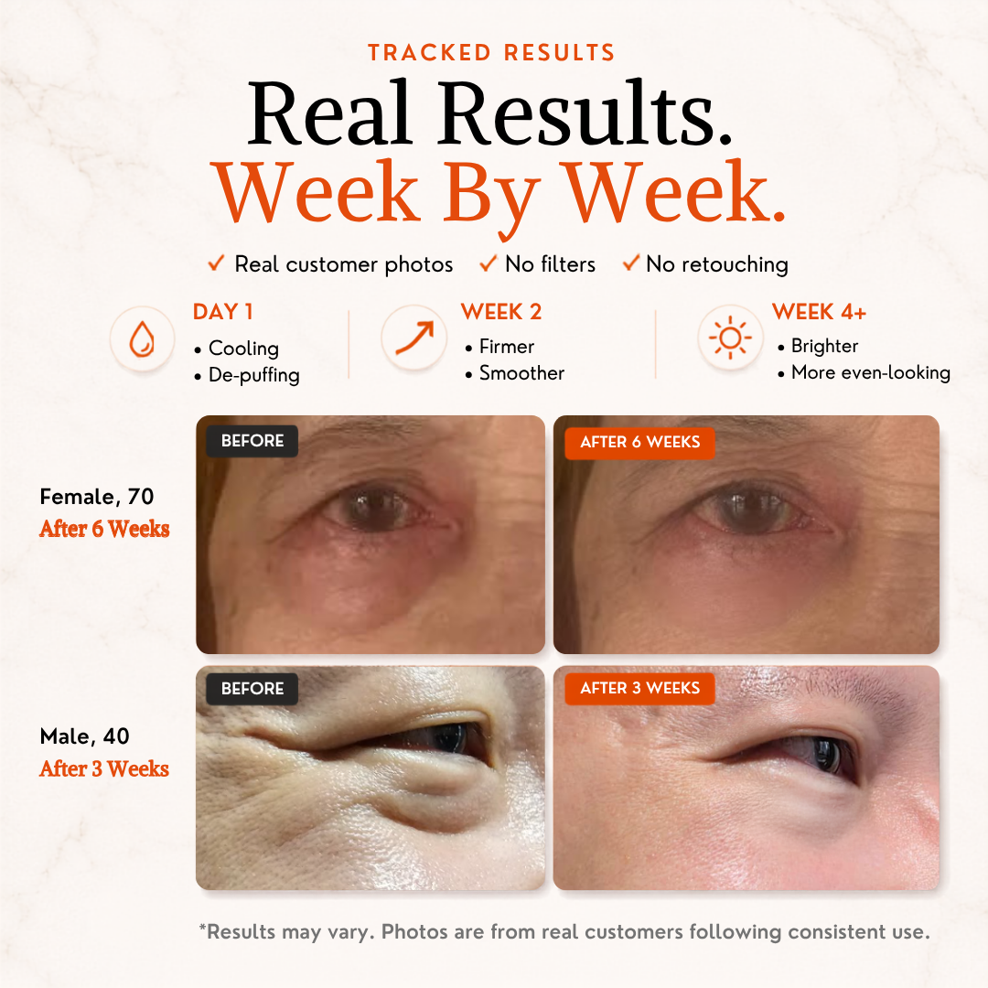 LED+EMS Anti Dark Circles Eye Cream