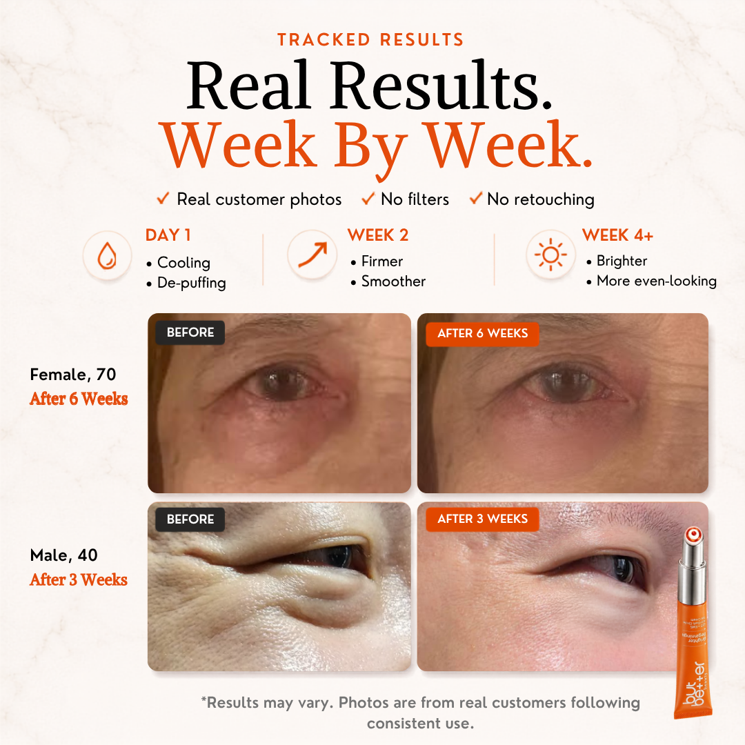 [20% OFF] Bundle Deals - Serum + Eye Cream
