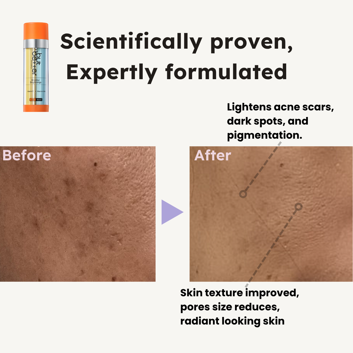 [20% OFF] Bundle Deals - Serum + Cleanser