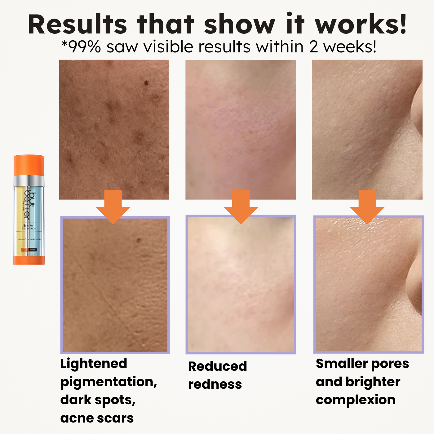 [20% OFF] Bundle Deals - Serum + Eye Cream